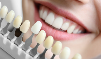 Cosmetic Dentistry - Vats & Param